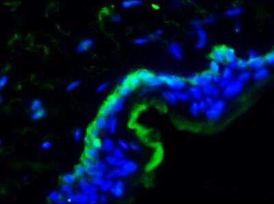 Immunohistochemistry-Frozen: Integrin alpha 3/CD49c Antibody (158A3) - BSA Free [NBP1-97691]