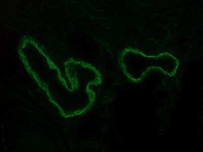 Immunohistochemistry-Frozen: Integrin alpha 3/CD49c Antibody (158A3) - BSA Free [NBP1-97691]