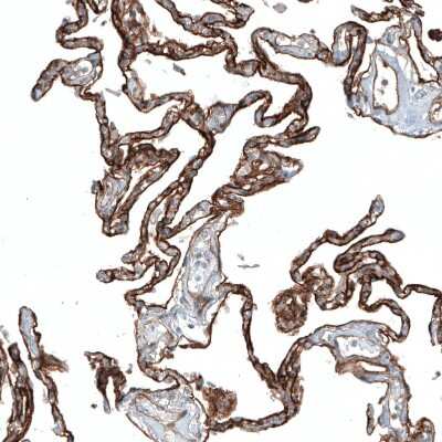 Immunohistochemistry-Paraffin: Integrin alpha 3/CD49c Antibody (CL6937) [NBP2-76515]