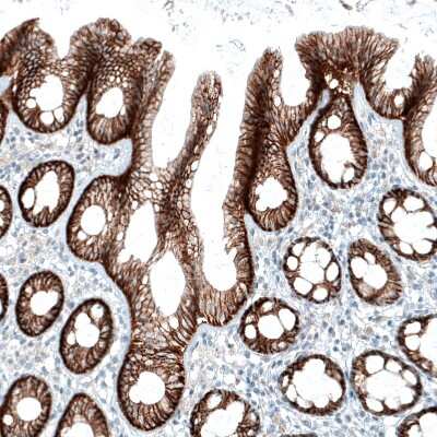 Immunohistochemistry-Paraffin: Integrin alpha 3/CD49c Antibody (CL6937) [NBP2-76515]