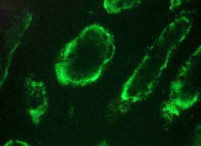 Immunocytochemistry/ Immunofluorescence: Integrin alpha 3B Antibody (PB36) - BSA Free [NBP1-97731]