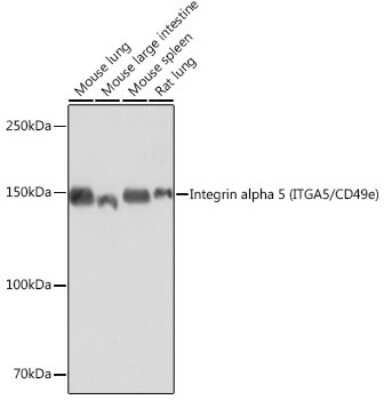 Western Blot: Integrin alpha 5/CD49e Antibody (8F2O6) [NBP3-15645]