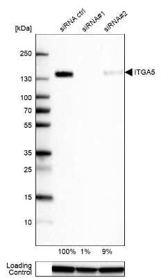 Western Blot: Integrin alpha 5/CD49e Antibody (CL6940) [NBP2-76518]