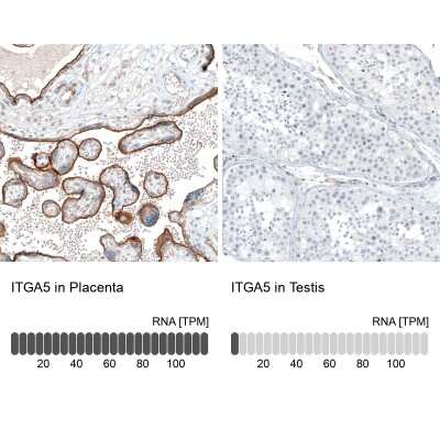 Immunohistochemistry-Paraffin: Integrin alpha 5/CD49e Antibody (CL6945) [NBP2-76519]