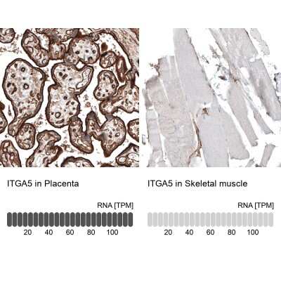 Immunohistochemistry-Paraffin: Integrin alpha 5/CD49e Antibody (CL6951) [NBP2-76520]