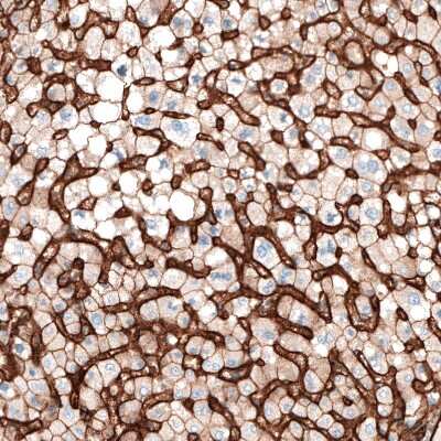 Immunohistochemistry-Paraffin: Integrin alpha 5/CD49e Antibody (CL6951) [NBP2-76520]