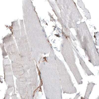 Immunohistochemistry-Paraffin: Integrin alpha 5/CD49e Antibody (CL6951) [NBP2-76520]