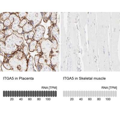 Immunohistochemistry-Paraffin: Integrin alpha 5/CD49e Antibody [NBP1-84576]
