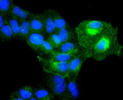 Immunocytochemistry/ Immunofluorescence: Integrin alpha 5/CD49e Antibody (JJ08-94) [NBP2-67883]