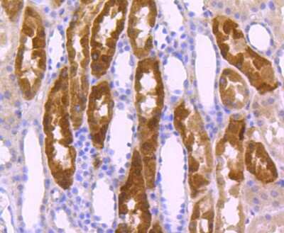 Immunohistochemistry-Paraffin: Integrin alpha 5/CD49e Antibody (JJ08-94) [NBP2-67883]