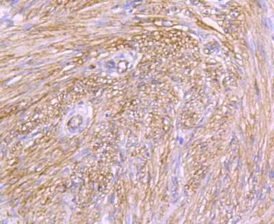 Immunohistochemistry-Paraffin: Integrin alpha 5/CD49e Antibody (JJ08-94) [NBP2-67883]