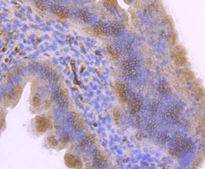 Immunohistochemistry-Paraffin: Integrin alpha 5/CD49e Antibody (JJ08-94) [NBP2-67883]