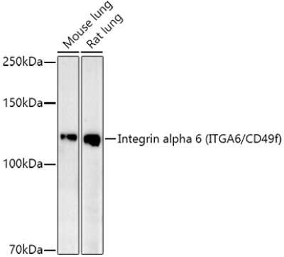 Western Blot: Integrin alpha 6/CD49f Antibody (7U5Z0) [NBP3-16085]
