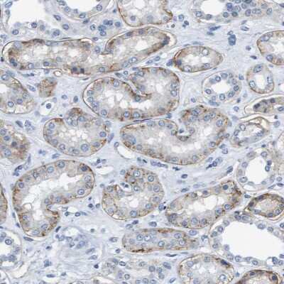 Immunohistochemistry-Paraffin: Integrin alpha 6/CD49f Antibody [NBP1-85747]