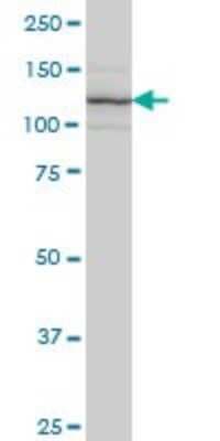 Western Blot: Integrin alpha 7 Antibody (8G2) [H00003679-M01]