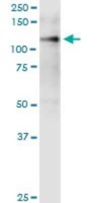 Western Blot: Integrin alpha 9 Antibody (3E4) [H00003680-M01]