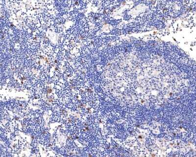 Immunohistochemistry-Paraffin: Integrin alpha E/CD103 Antibody (SN62-06) [NBP2-67663]