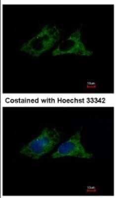 Immunocytochemistry/ Immunofluorescence: Integrin beta 1/CD29 Antibody [NBP2-16974]
