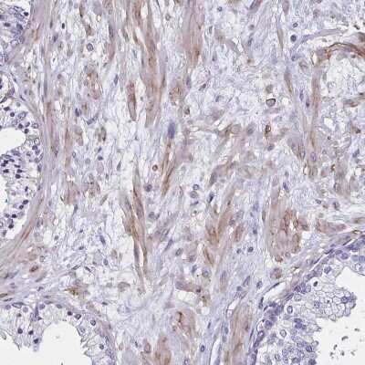 Immunohistochemistry-Paraffin: Integrin beta 1/CD29 Antibody [NBP2-62630]