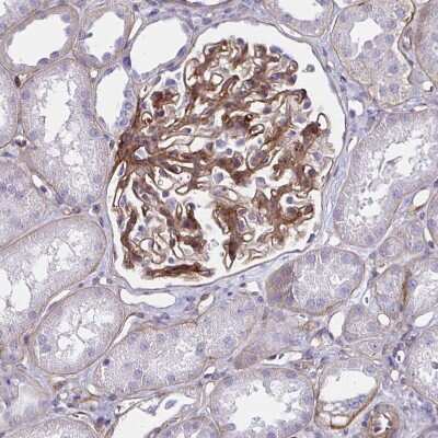 Immunohistochemistry-Paraffin: Integrin beta 1/CD29 Antibody [NBP2-62630]