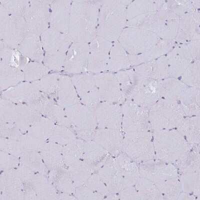 Immunohistochemistry-Paraffin: Integrin beta 1/CD29 Antibody [NBP2-62630]