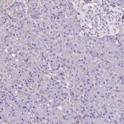 Immunohistochemistry-Paraffin: Integrin beta 1/CD29 Antibody [NBP2-62630]