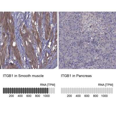 Immunohistochemistry-Paraffin: Integrin beta 1/CD29 Antibody [NBP2-62660]