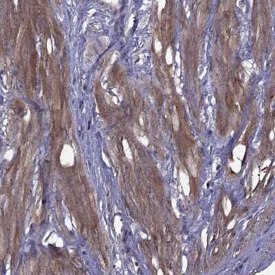 Immunohistochemistry-Paraffin: Integrin beta 1/CD29 Antibody [NBP2-62660]