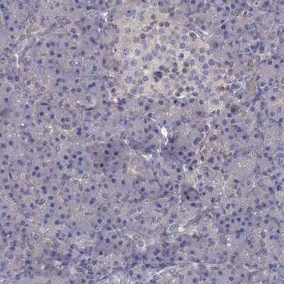 Immunohistochemistry-Paraffin: Integrin beta 1/CD29 Antibody [NBP2-62660]