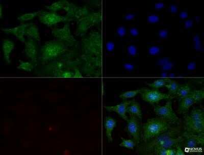 Immunocytochemistry/ Immunofluorescence: Integrin beta 1/CD29 Antibody (P4C10) - Azide and BSA Free [NBP2-80818]