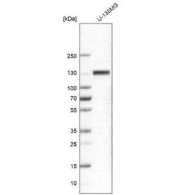 Western Blot: Integrin beta 1/CD29 Antibody [NBP2-62630]