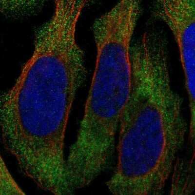 Immunocytochemistry/ Immunofluorescence: Integrin beta 2/CD18 Antibody [NBP1-88127]