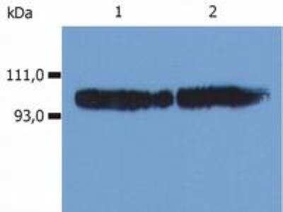 Radioimmunoassay: Integrin beta 2/CD18 Antibody (MEM-48)BSA Free [NB500-379]