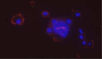 Immunocytochemistry/ Immunofluorescence: Integrin beta 2/CD18 Antibody (YFC118.3) - BSA Free [NB200-610]
