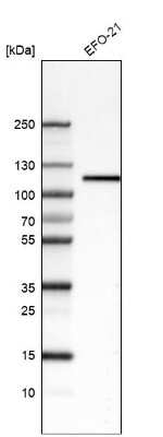 Western Blot: Integrin beta 3/CD61 Antibody (CL7319) [NBP2-76484]