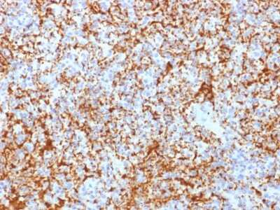 Immunohistochemistry-Paraffin: Integrin beta 3/CD61 Antibody (ITGB3/2166R) [NBP3-07558]
