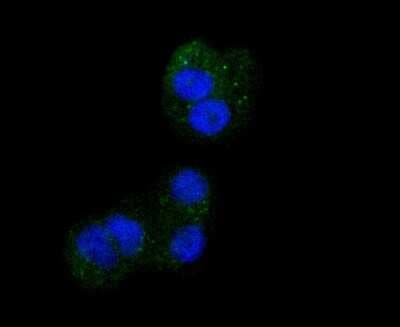 Immunocytochemistry/ Immunofluorescence: Integrin beta 3/CD61 Antibody (SJ19-09) [NBP2-67416]