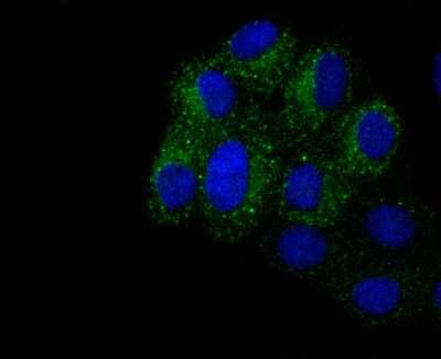 Immunocytochemistry/ Immunofluorescence: Integrin beta 3/CD61 Antibody (SJ19-09) [NBP2-67416]
