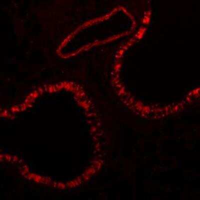 Immunohistochemistry-Paraffin: Integrin beta 3/CD61 Antibody (SJ19-09) [NBP2-67416]