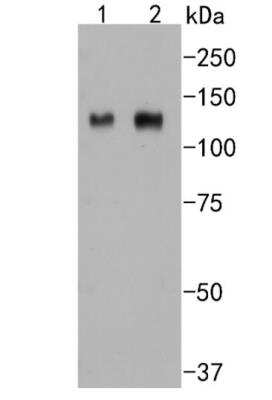 Western Blot: Integrin beta 3/CD61 Antibody (SJ19-09) [NBP2-67416]