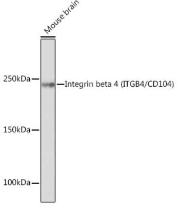 Western Blot: Integrin beta 4/CD104 Antibody (5Z9P3) [NBP3-16446]