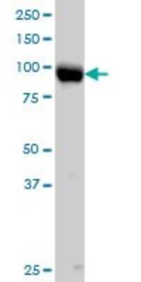 Western Blot: Integrin beta 5 Antibody (2C4) [H00003693-M01]