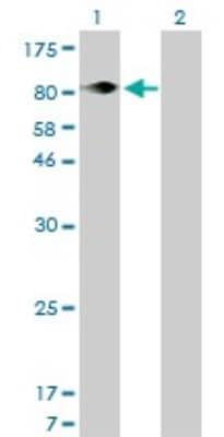 Western Blot: Integrin beta 5 Antibody (2C4) [H00003693-M01]