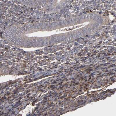 Immunohistochemistry-Paraffin: Integrin beta 5 Antibody [NBP1-88117]