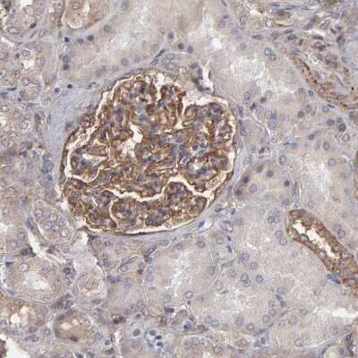 Immunohistochemistry-Paraffin: Integrin beta 5 Antibody [NBP1-88117]