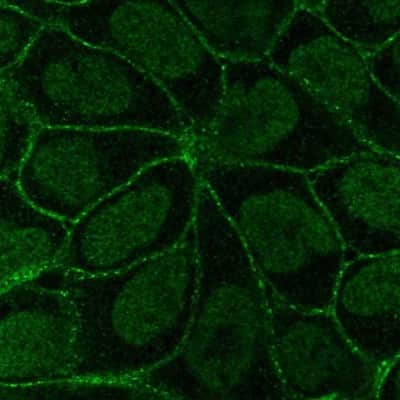 Immunocytochemistry/ Immunofluorescence: Integrin beta 6 Antibody [NBP2-14136]