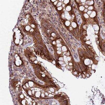 Immunohistochemistry-Paraffin: Integrin beta 6 Antibody [NBP2-14136]