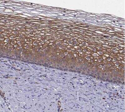 Immunohistochemistry-Paraffin: Integrin beta 8 Antibody [NBP1-87539]
