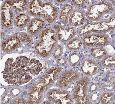 Immunohistochemistry-Paraffin: Integrin beta 8 Antibody [NBP1-87539]