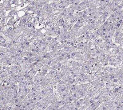 Immunohistochemistry-Paraffin: Integrin beta 8 Antibody [NBP1-87539]